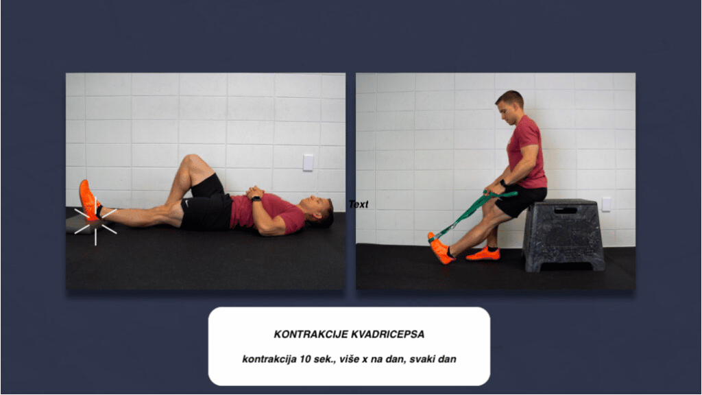 vežbe za kvadriceps nakon operacije kolena