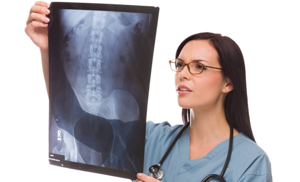 snimak kičme kod spondiloze